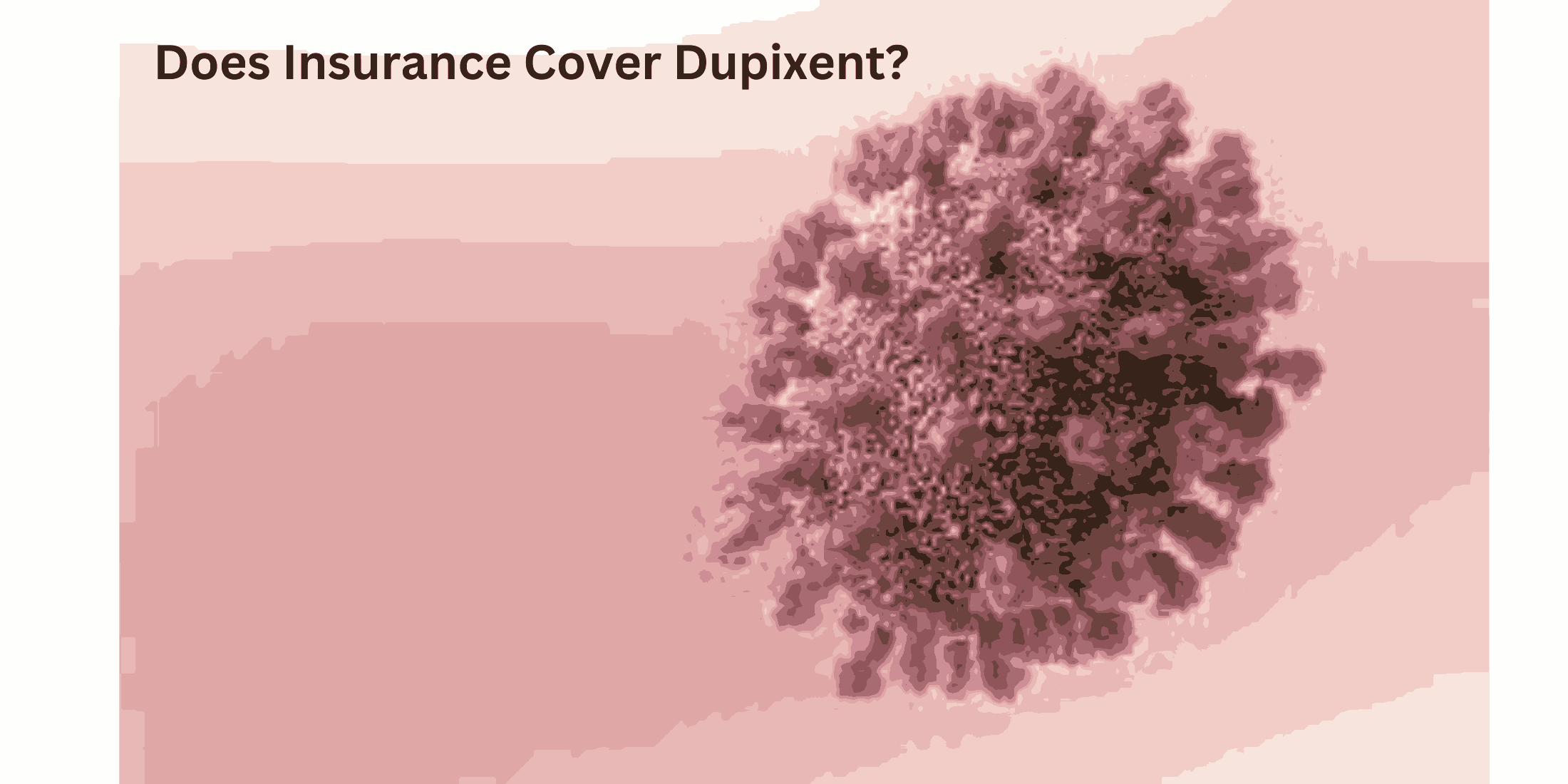 does insurance cover dupixent